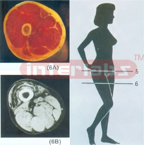 ANATOMICAL DISL MODEL OF FEMALE HUMAN TORSO Section 6